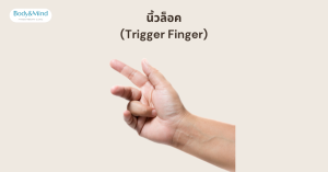 นิ้วล็อค (Trigger Finger)