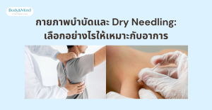กายภาพบำบัดและ Dry Needling: เลือกอย่างไรให้เหมาะกับอาการ